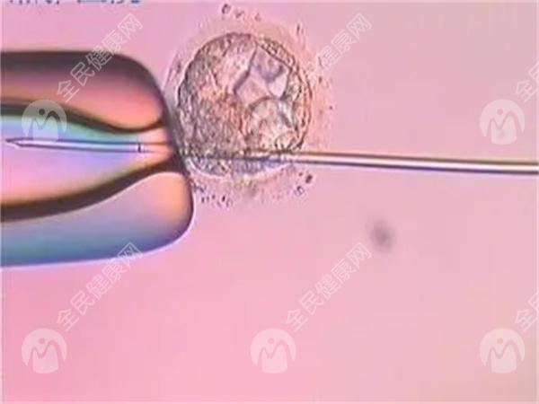 重庆第二代试管婴儿费用明细是怎么样的？详细解读