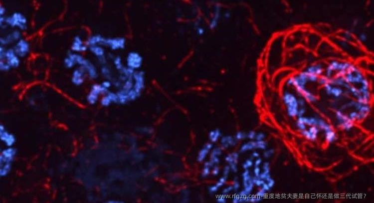 重度地贫夫妻是自己怀还是做三代试管？