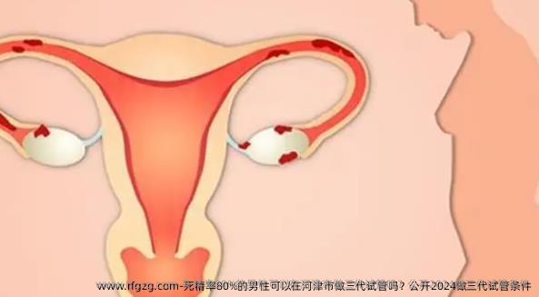 死精率80%的男性可以在河津市做三代试管吗？公开2024做三代试管条件