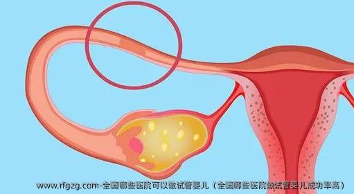 国内哪些医院可以做试管婴儿（国内哪些医院做试管婴儿成功率高）