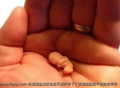 尿液加盐为红色是不是怀孕了？尿液加盐能不能测出怀孕