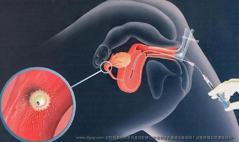 女性有染色体罗氏易位在枝江市做试管养囊成功率高吗？试管移植后需要保胎吗！
