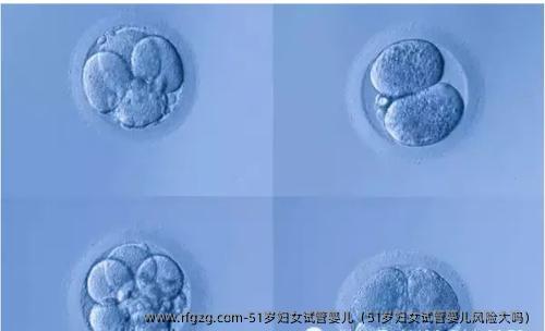 51岁妇女试管婴儿（51岁妇女试管婴儿风险大吗）