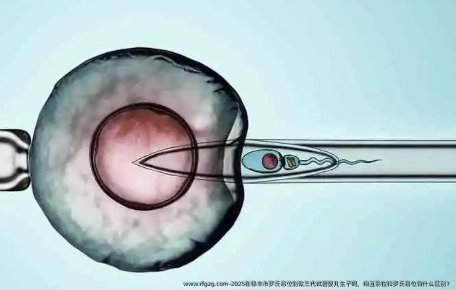 2025在禄丰市罗氏易位能做三代试管婴儿生子吗，相互易位和罗氏易位有什么区别？