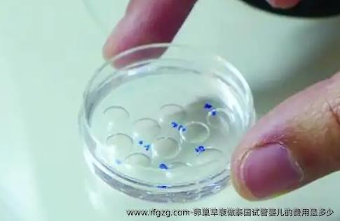 卵巢早衰做泰国试管婴儿的费用是多少