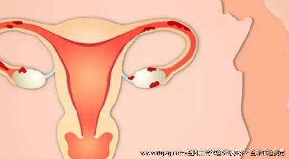 兰州三代试管价格多少？兰州试管费用
