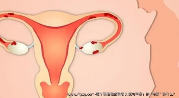 哪个医院做试管婴儿成功率高？的“秘籍”是什么？