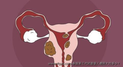 泰国第三代试管婴儿费用大约多少？