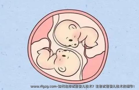 如何选择试管婴儿技术？注意试管婴儿技术的细节！