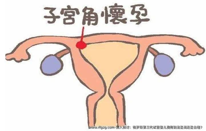 深入探讨：俄罗斯第三代试管婴儿费用到底是高还是合理？