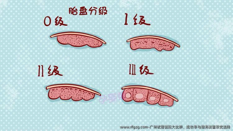 广州试管医院大比拼，成功率与服务质量双优选择