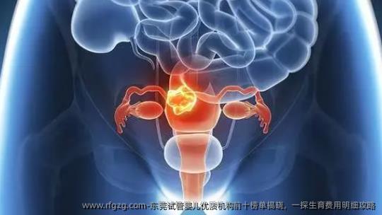 东莞试管婴儿优质机构前十榜单揭晓，一探生育费用明细攻略