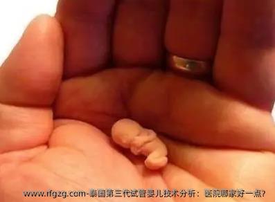 泰国第三代试管婴儿技术分析：医院哪家好一点？