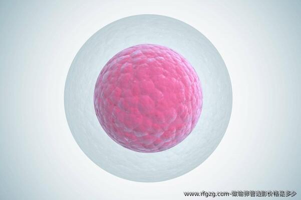 做输卵管造影价格是多少？输卵管造影的基本概念是什么？