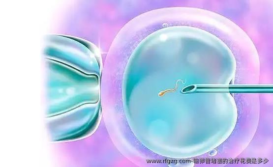 输卵管堵塞的治疗花费是多少？