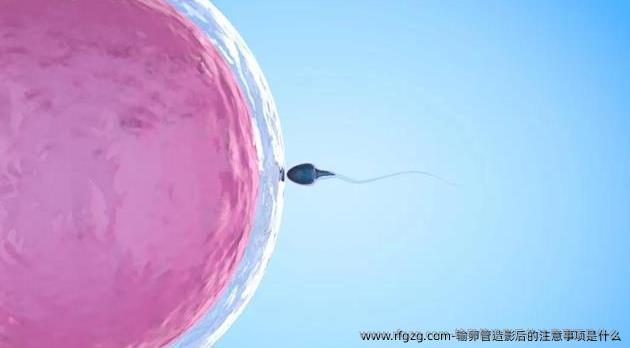 输卵管造影后的注意事项是什么？