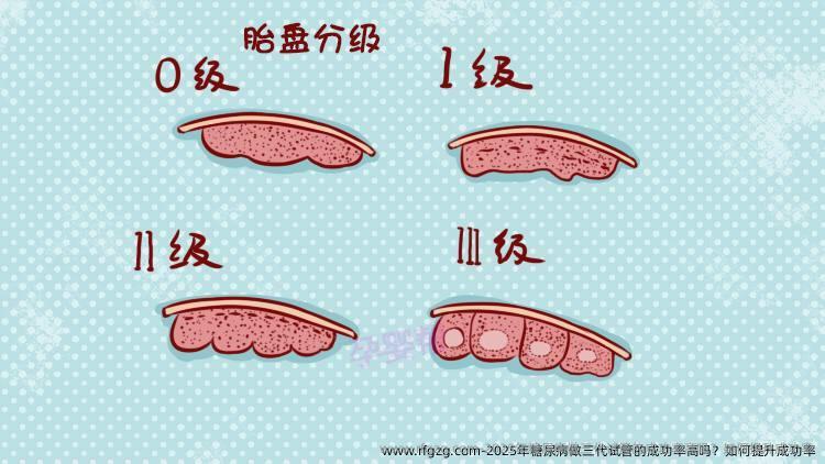 2025年糖尿病做三代试管的成功率高吗？如何提升成功率