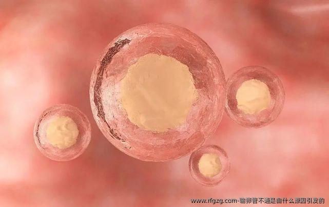 输卵管不通是由什么原因引发的