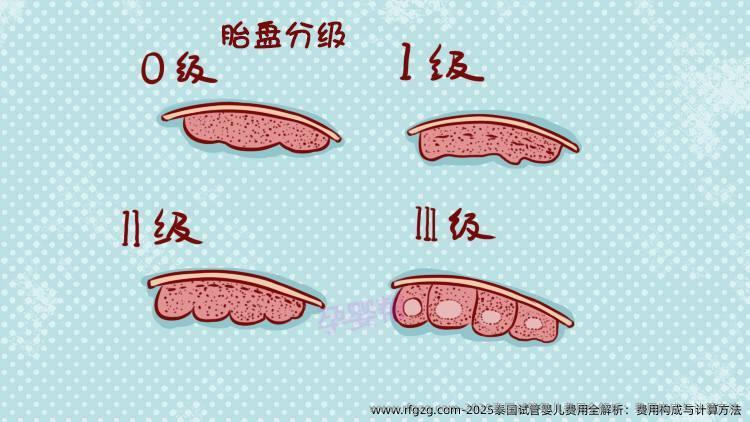 2025泰国试管婴儿费用全解析：费用构成与计算方法