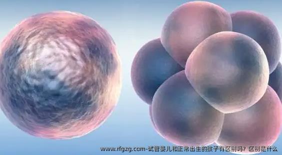 试管婴儿和正常出生的孩子有区别吗？区别是什么
