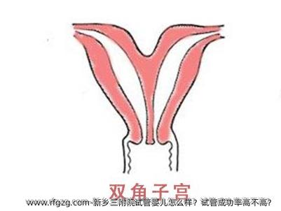 新乡三附院试管婴儿怎么样？试管成功率高不高？
