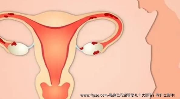 福建三代试管婴儿十大医院？有什么条件！