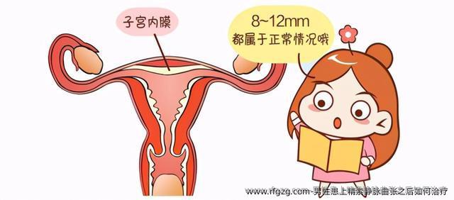 男性患上精索静脉曲张之后如何治疗