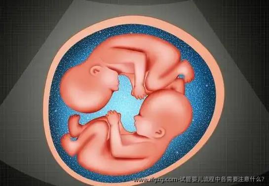 试管婴儿流程中各需要注意什么?