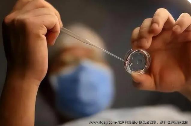 北京月经量少是怎么回事，是什么原因造成的