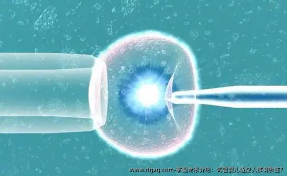 家圆专家介绍：试管婴儿适应人群有哪些?