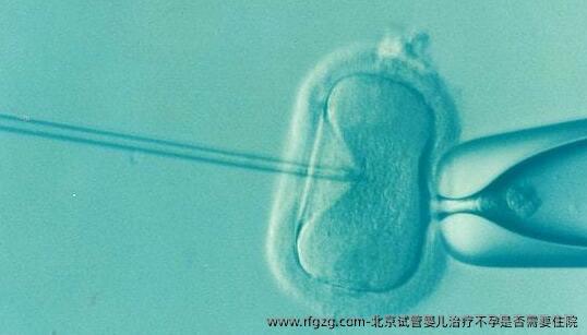 北京试管婴儿治疗不孕是否需要住院
