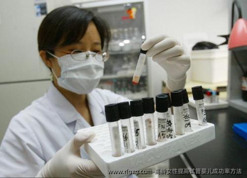 高龄女性提高试管婴儿成功率方法