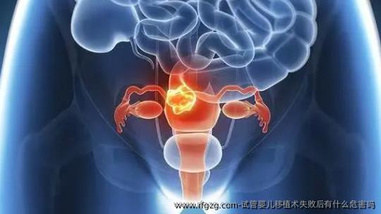 试管婴儿移植术失败后有什么危害吗