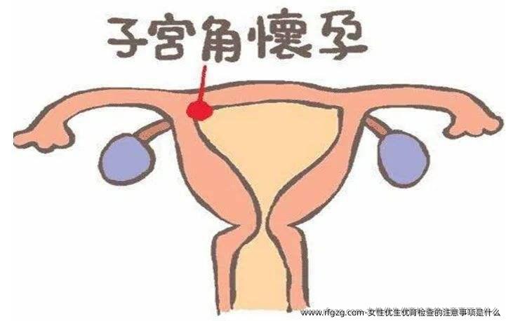 女性优生优育检查的注意事项是什么