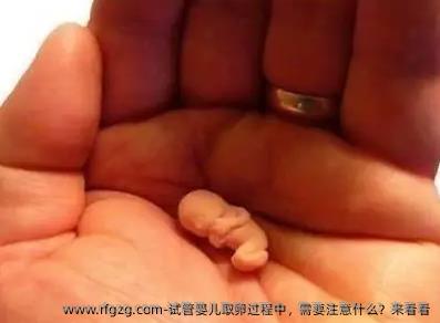 试管婴儿卵泡取出过程中，需要注意什么？来看看