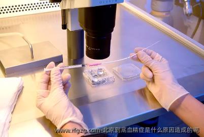 北京到底血精症是什么原因造成的呢
