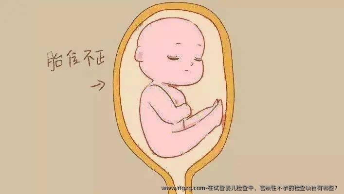 在试管婴儿检查中，宫颈性不孕的检查项目有哪些？