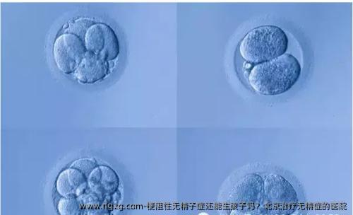 梗阻性无精子症还能生孩子吗？北京治疗无精症的医院