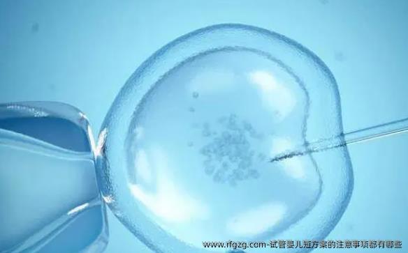试管婴儿短方案的注意事项都有哪些