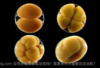 女性多囊卵巢能治愈吗？需要多久才能被完全治愈？
