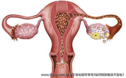 精液不液化能怀孕吗?如何预防精液不液化?
