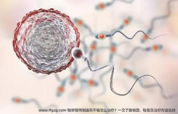 输卵管两侧通而不畅怎么治疗？一文了解病因、检查及治疗方案选择