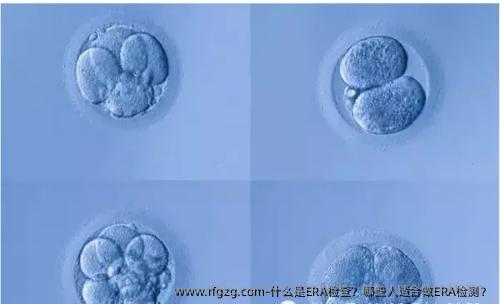 什么是ERA检查？哪些人适合做ERA检测？