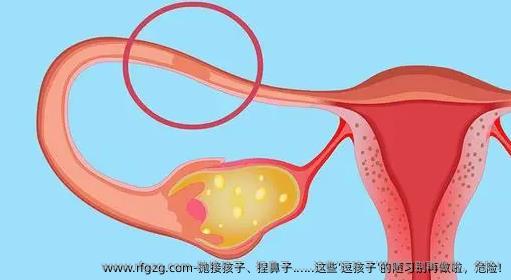抛接孩子、捏鼻子......这些‘逗孩子’的陋习别再做啦，危险!