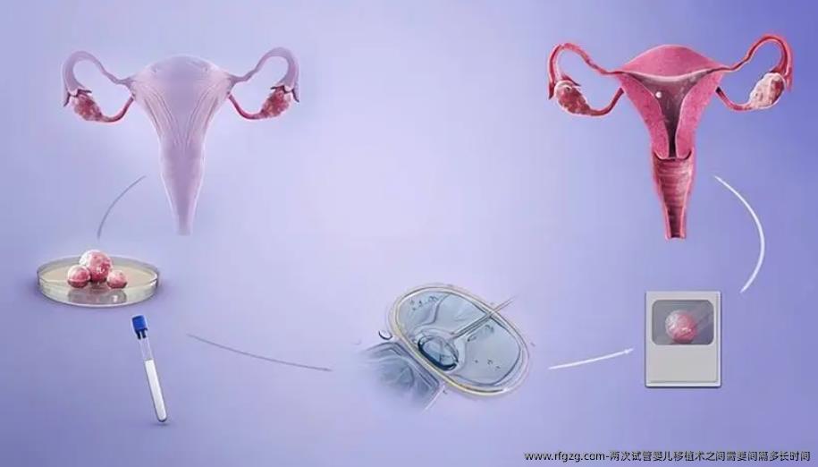 两次试管婴儿移植术之间需要间隔多长时间