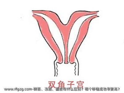 鲜胚、冻胚、囊胚有什么区别？哪个移植成功率更高？