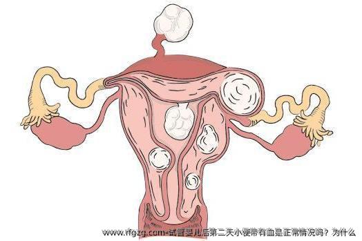 试管婴儿后第二天小便带有血是正常情况吗？为什么
