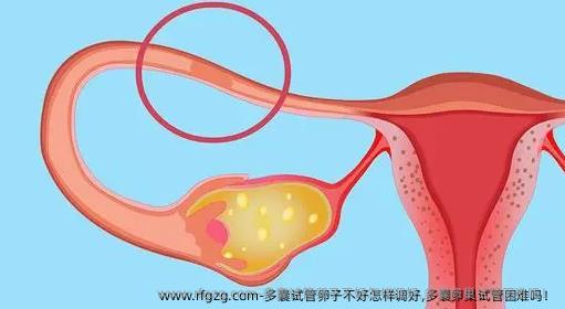 多囊试管卵子不好怎样调好,多囊卵巢试管困难吗！