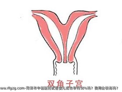 菏泽市中医医院试管婴儿成功率有50%吗？费用会很高吗？