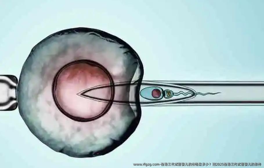 香港三代试管婴儿的价格是多少？附2025香港三代试管婴儿的条件